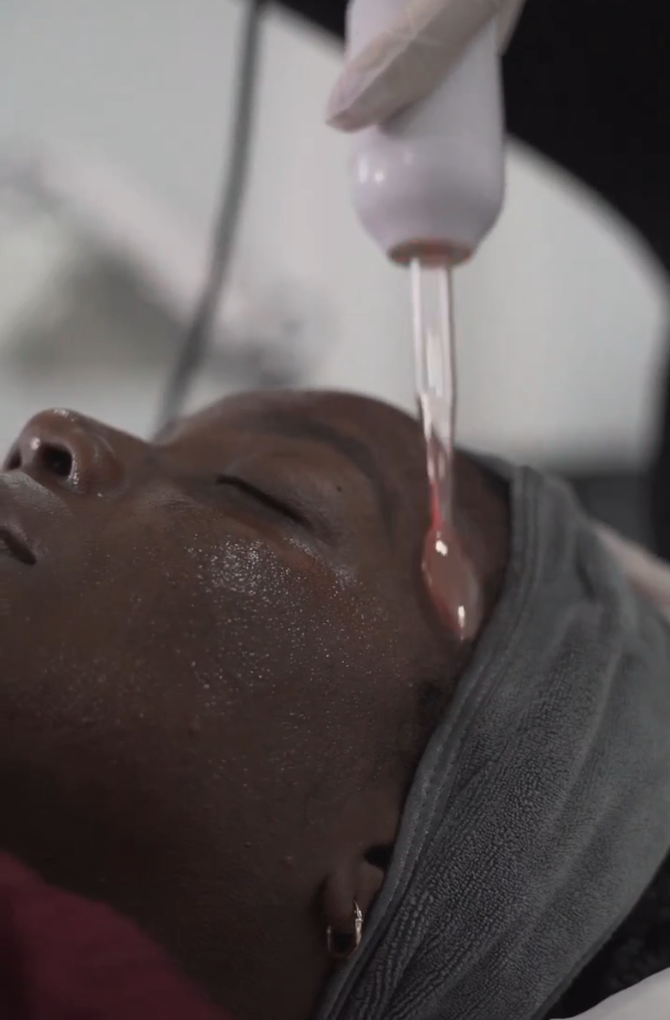 High Frequency Clarifying Therapy (Add-on)