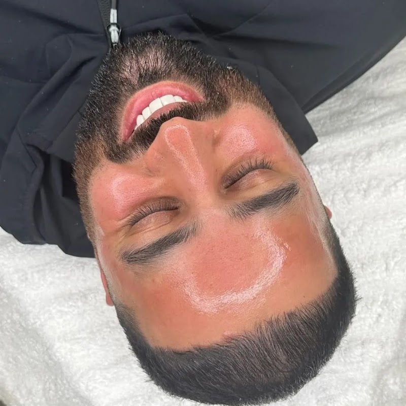 Aquapure Hydrodermabrasion [3+1 Package]