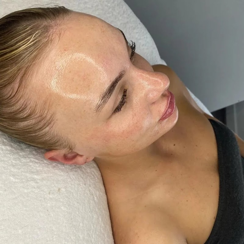 Aquapure Hydrodermabrasion [3+1 Package] - Image 2