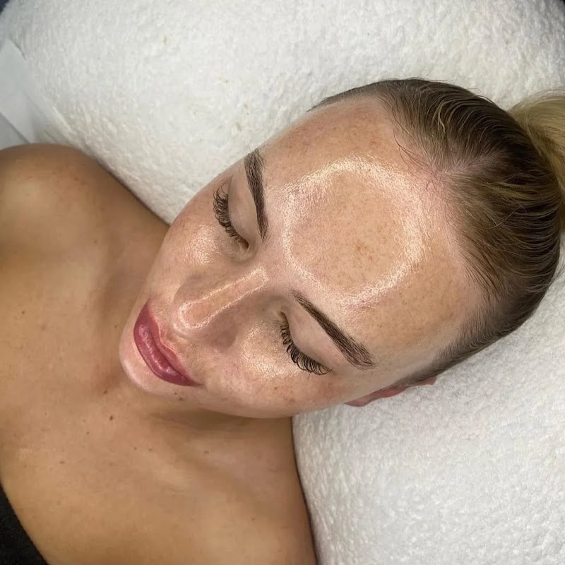 Aquapure Hydrodermabrasion [3+1 Package] - Image 3