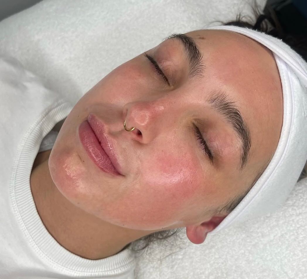 Diamond Radiance Microdermabrasion LED