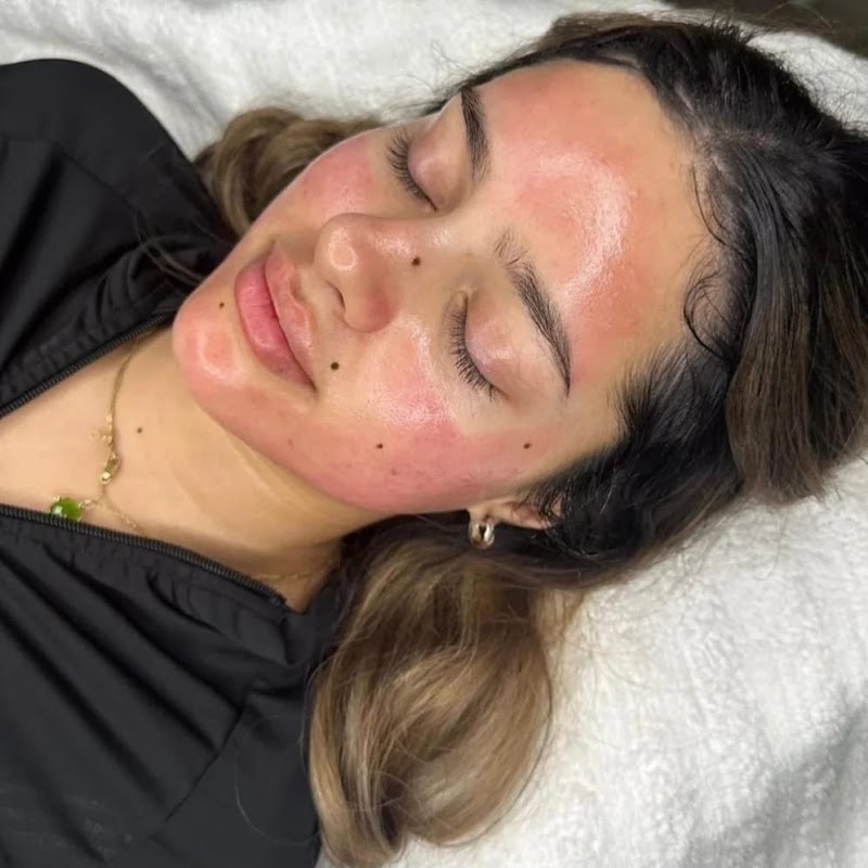 Microdermabrasion, Mask + LED Light Therapy [3+1 Package] - Image 1