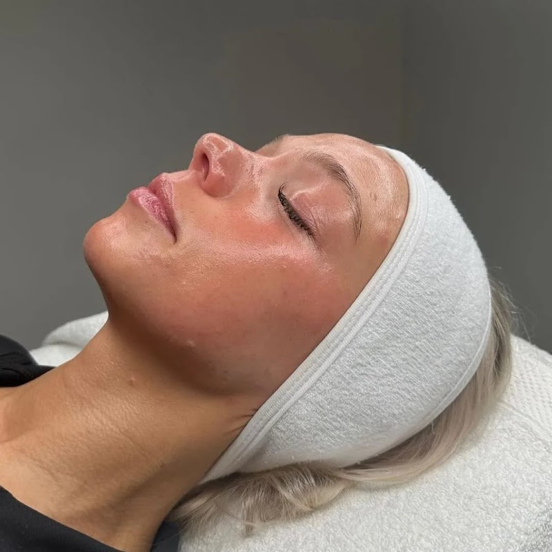 Custom Spa Facial [3+1 Package] - Image 1