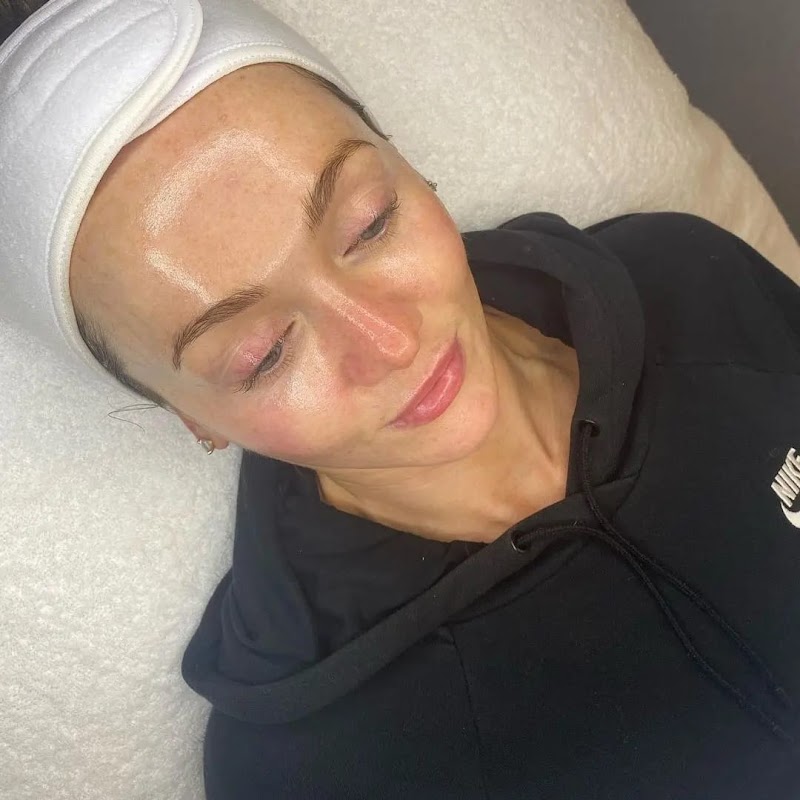 Aquapure Hydrodermabrasion [3+1 Package] - Image 4